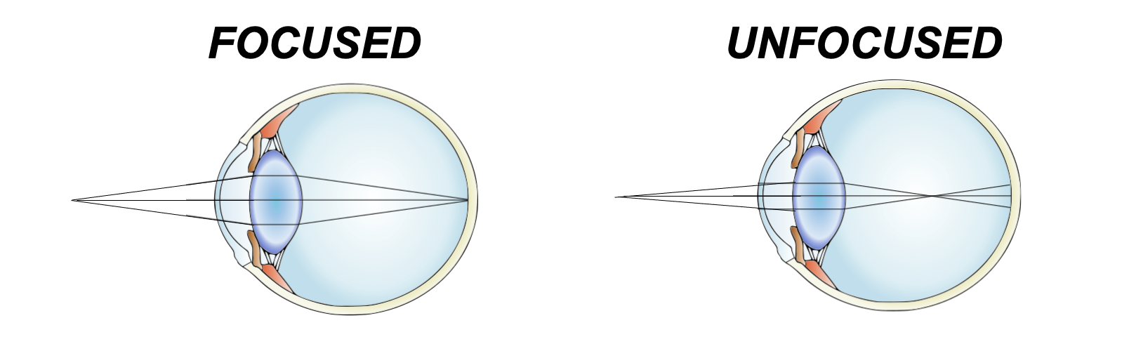 Our lenses refract light so that light rays of objects we look at end up in focus.