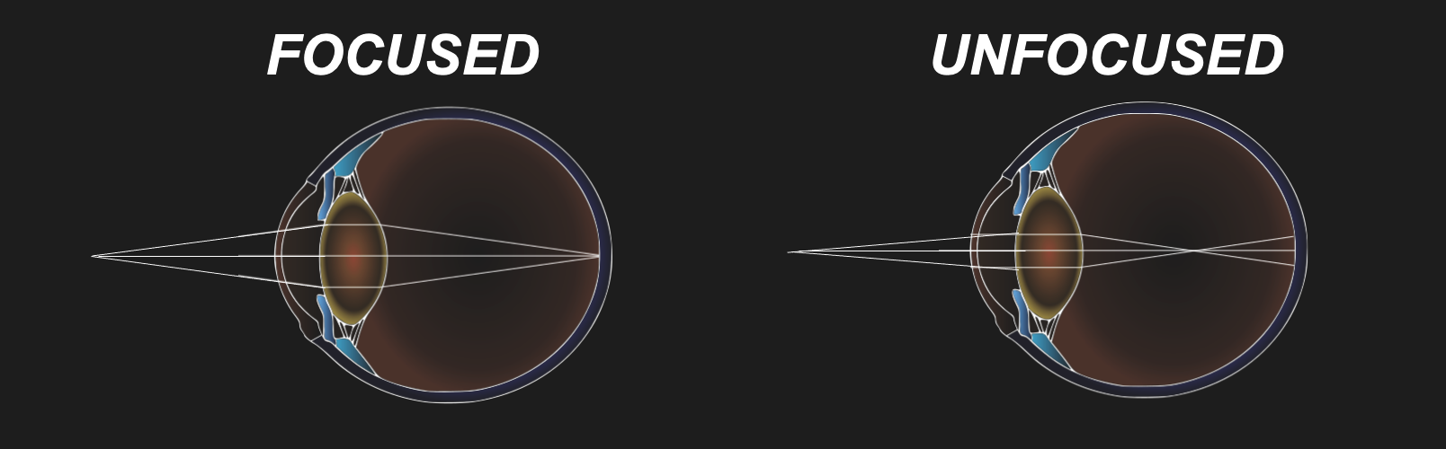 Our lenses refract light so that light rays of objects we look at end up in focus.